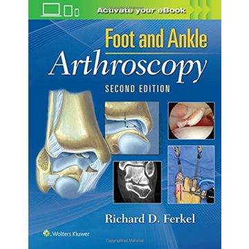 Foot & Ankle Arthroscopy, 2/Ed.     [Ferkel - LIPPINCOTT Williams and Wilkins]