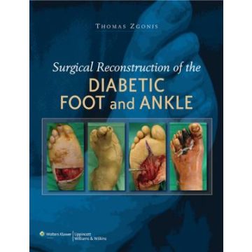 Surgical Reconstruction of the Diabetic Foot and Ankle  Zgonis Thomas  LIPPINCOTT Williams and Wilkins  9780781784580
