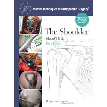 The Master Techniques in Orthopaedic Surgery: Shoulder, 3ed.  Craig Edward V.  LIPPINCOTT Williams and Wilkins  9780781797481