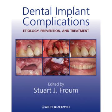 Dental Implant Complications: Etiology, Prevention, and Treatment  Froum Stuart J.  Wiley - Blackwell  9780813808413