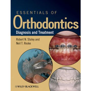 Essentials of Orthodontics: Diagnosis and Treatment  Staley Robert N.; Reske Neil T.  Wiley - Blackwell  9780813808680