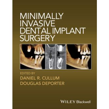 Minimally Invasive Dental Implant Surgery  Cullum Daniel R.; Depoter Douglas  Wiley - Blackwell  9780813814520