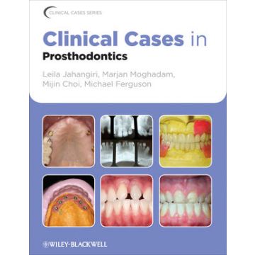 Clinical Cases in Prosthodontics  Jahangiri Leila; Moghadam Marjan; Choi Mijin; Ferguson Michael  Wiley - Blackwell  9780813816647