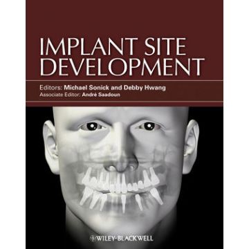 Implant Site Development  Sonick Michael; Hwang Debby  Wiley - Blackwell  9780813825120