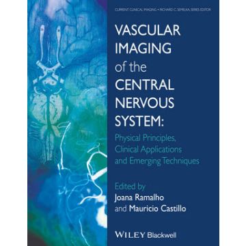 Vascular Imaging of the Central Nervous System: Physical Principles, Clinical Applications and Emerging Techniques  Ramalho Joana; Castillo Mauricio  Wiley - Blackwell  9781118188750