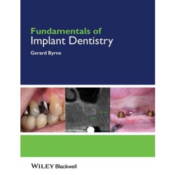 Fundamentals of Implant Dentistry  Byrne Gerard  Wiley - Blackwell  9781118274965