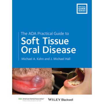 The ADA Practical Guide to Soft Tissue Oral Disease  Kahn Michael A.; Hall J. Michael  Wiley - Blackwell  9781118277973