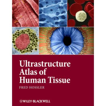 Ultrastructure Atlas of Human Tissues  Hossler Fred  Wiley - Blackwell  9781118284537