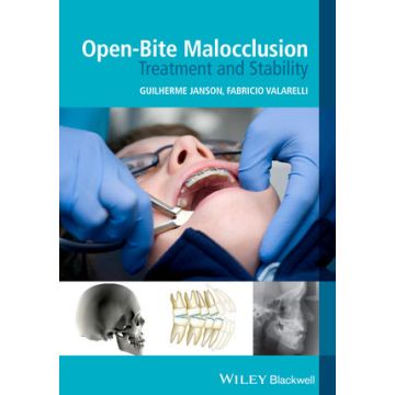 Open-Bite Malocclusion: Treatment and Stability  Janson Guilherme; Valarelli Fabricio  Wiley - Blackwell  9781118335987