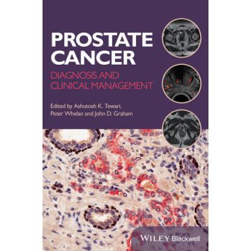 Prostate Cancer: Diagnosis and Clinical Management  Whelan Peter; Tewari Ashutosh K.; Graham John D.  Wiley - Blackwell  9781118347355