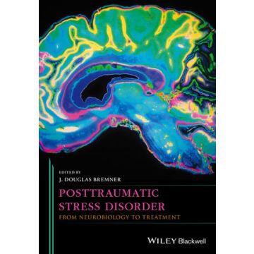 Posttraumatic Stress Disorder: From Neurobiology to Treatment  Bremner J. Douglas  Wiley - Blackwell  9781118356111