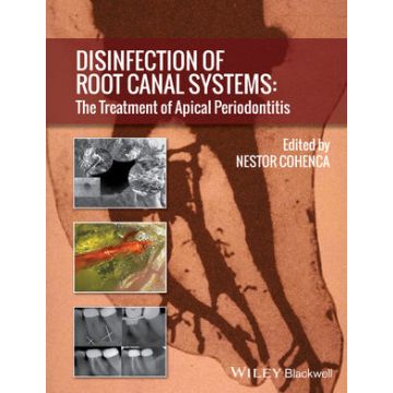Disinfection of Root Canal Systems: The Treatment of Apical Periodontitis  Cohenca Nestor  Wiley - Blackwell  9781118367681