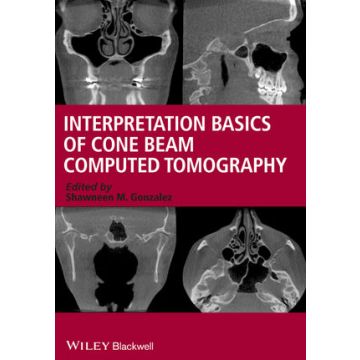 Interpretation Basics of Cone Beam Computed Tomography  Gonzalez Shawneen M.  Wiley - Blackwell  9781118381069