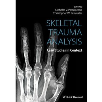 Skeletal Trauma Analysis: Case Studies in Context  Passalacqua Nicholas V.; Rainwater Christopher W.  Wiley - Blackwell  9781118384220