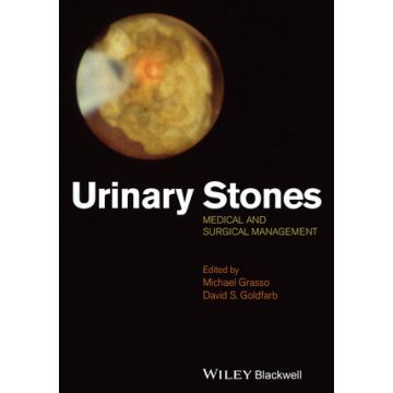 Urinary Stones: Medical and Surgical Management  Grasso Michael; Goldfarb David  Wiley - Blackwell  9781118405437