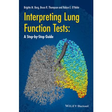 Interpreting Lung Function Tests: A Step-by Step Guide  Thompson Bruce; Borg Brigitte; O’Hehir Robyn  Wiley - Blackwell  9781118405512