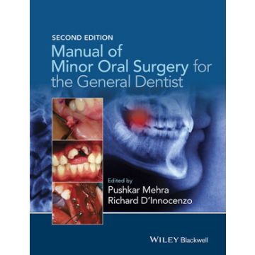 Manual of Minor Oral Surgery for the General Dentist, 2ed.  Mehra Pushkar; D’Innocenzo Richard  Wiley - Blackwell  9781118432150