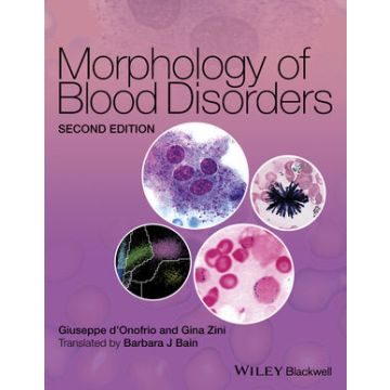 Morphology of Blood Disorders, 2ed.  d'Onofrio Giuseppe; Zini Gina  Wiley - Blackwell  9781118442609