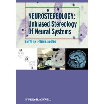 Neurostereology: Unbiased Stereology of Neural Systems  Mouton Peter R.  Wiley - Blackwell  9781118444214