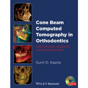Cone Beam Computed Tomography in Orthodontics: Indications, Insights, and Innovations  Kapila Sunil  Wiley - Blackwell  9781118448489