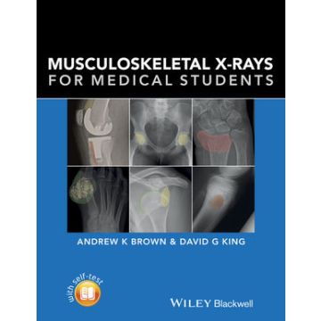 Musculoskeletal X-rays for Medical Students  Brown Andrew; King David  Wiley - Blackwell  9781118458730