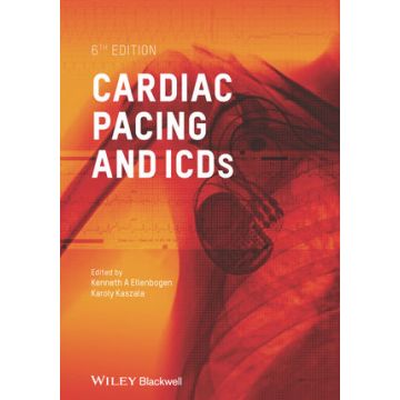 Cardiac Pacing and ICDs, 6ed.  Ellenbogen Kenneth A.; Kaszala Karoly  Wiley - Blackwell  9781118459515