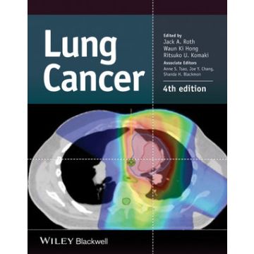 Lung Cancer, 4ed.  Roth  Jack A.; Hong Waun Ki; Komaki Ritsuko U.  Wiley - Blackwell  9781118468746