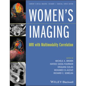 Women's Imaging: MRI with Multimodality Correlation  Brown Michele A.; Ojeda-Fournier Haydee; Djilas Dragana; El-Azzazi Mohamed; Semelka Richard C.  Wiley - Blackwell  9781118482841