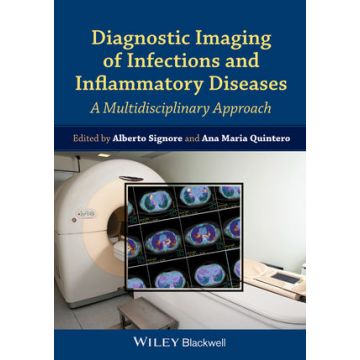 Diagnostic Imaging of Infections and Inflammatory Diseases: A Multidiscplinary Approach  Signore Alberto; Quintero Ana Maria  Wiley - Blackwell  9781118484418