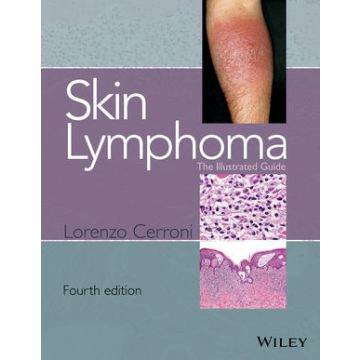 Skin Lymphoma: The Illustrated Guide, 4ed.  Cerroni Lorenzo  Wiley - Blackwell  9781118492499