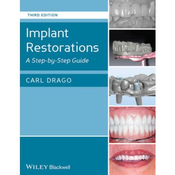 Implant Restorations: A Step-by-Step Guide, 3ed.  Drago Carl  Wiley - Blackwell  9781118513057