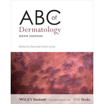 ABC of Dermatology, 6ed.  Morris-Jones Rachael  Wiley - Blackwell  9781118520154