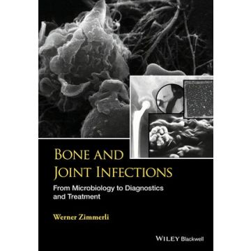 Bone and Joint Infections: From Microbiology to Diagnostics and Treatment  Zimmerli Werner  Wiley - Blackwell  9781118581773