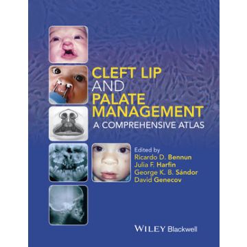 Cleft Lip and Palate Management: A Comprehensive Atlas  Bennun Ricardo D.; Harfin Julia F.; Sándor George K. B., Genecov David  Wiley - Blackwell  9781118607541