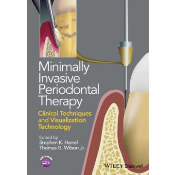 Minimally Invasive Periodontal Therapy: Clinical Techniques and Visualization Technology  Harrel Stephen K.; Wilson Thomas G.  Wiley - Blackwell  9781118607626