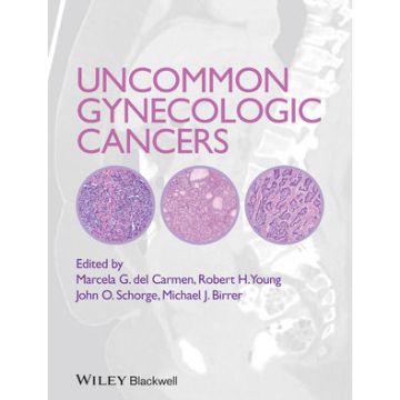 Uncommon Gynecologic Cancers  del Carmen Marcela; Schorge John O.; Young Robert H.  Wiley - Blackwell  9781118655351