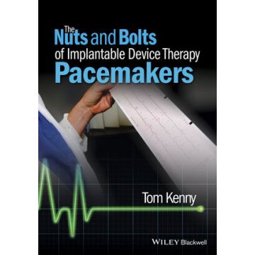 The Nuts and Bolts of Implantable Device Therapy: Pacemakers  Kenny Tom  Wiley - Blackwell  9781118670675
