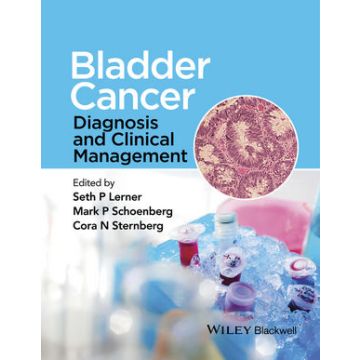 Bladder Cancer: Diagnosis and Clinical Management  Lerner Seth P.; Schoenberg Mark P.; Sternberg Cora N.  Wiley - Blackwell  9781118674840
