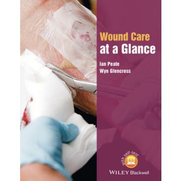 Wound Care at a Glance  Peate Ian; Glencross Wyn  Wiley - Blackwell  9781118684672