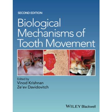 Biological Mechanisms of Tooth Movement, 2ed.  Krishnan Vinod; Davidovitch Ze'ev  Wiley - Blackwell  9781118688878