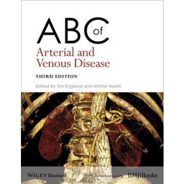 ABC of Arterial and Venous Disease, 3ed.  England Tim; Nasim Akhtar  Wiley - Blackwell  9781118740682