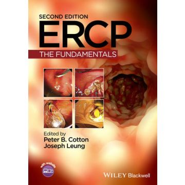ERCP: The Fundamentals, 2ed.  Cotton Peter B.; Leung Joseph W.  Wiley - Blackwell  9781118769416