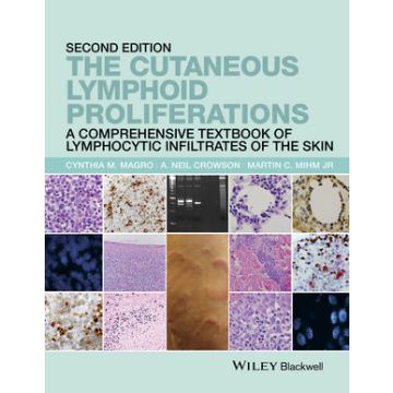 The Cutaneous Lymphoid Proliferations: A Comprehensive Textbook of Lymphocytic Infiltrates of the Skin, 2ed.  Magro Cynthia M.; Crowson A. Neil; Mihm Martin C.  Wiley - Blackwell  9781118776261