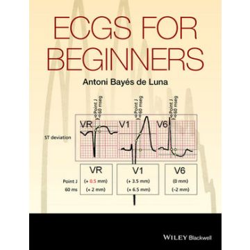 ECGs for Beginners  Bayes de Luna Antoni  Wiley - Blackwell  9781118821312