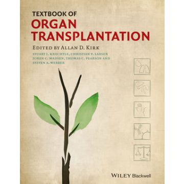 Textbook of Organ Transplantation Set  Kirk Allan D.; Knechtle Stuart J.; Larsen Christian P.; Madsen Joren C.  Wiley - Blackwell  9781118870143