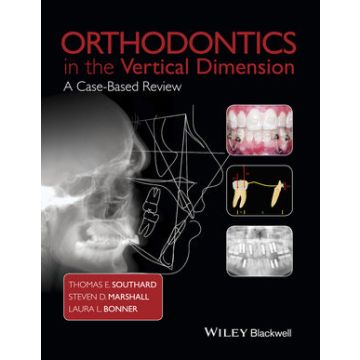 Orthodontics in the Vertical Dimension: A Case-Based Review  Southard Thomas E.; Marshall Steven D.; Bonner Laura L.  Wiley - Blackwell  9781118870211