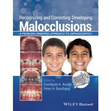 Recognizing and Correcting Developing Malocclusions: A Problem-Oriented Approach to Orthodontics  Araújo Eustáquio A.; Buschang Peter H.  Wiley - Blackwell  9781118886120