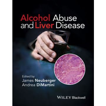 Alcohol Abuse and Liver Disease  Neuberger James; DiMartini Andrea  Wiley - Blackwell  9781118887288