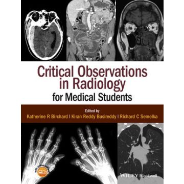 Critical Observations in Radiology for Medical Students  Birchard Katherine R.; Busireddy Kiran Reddy; Semelka Richard C.  Wiley - Blackwell  9781118904718