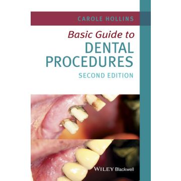 Basic Guide to Dental Procedures, 2ed.  Hollins Carole  Wiley - Blackwell  9781118924556